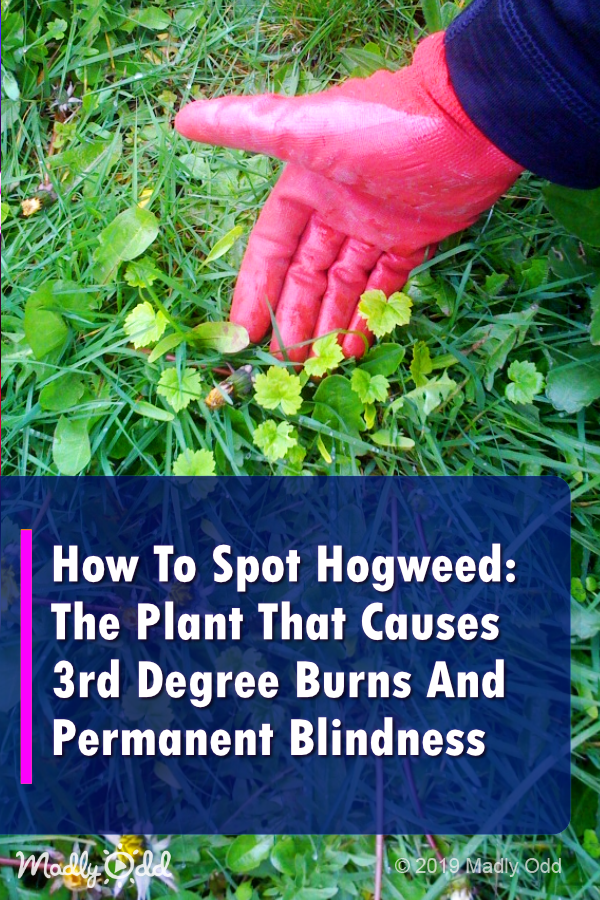 America\'s Most Dangerious Plant: Hogweed is Spreading Across The U.S.