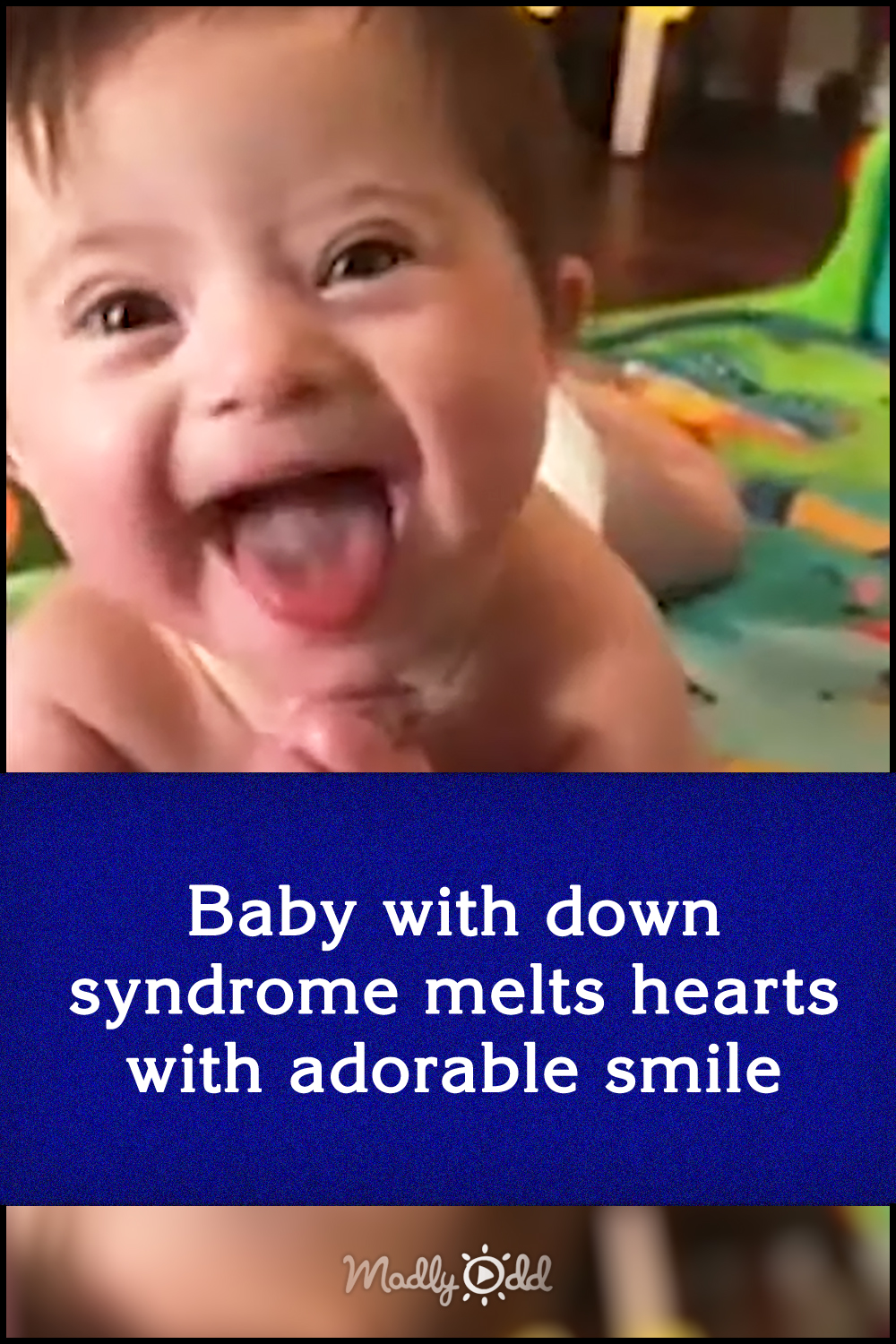 Baby with down syndrome melts hearts with adorable smile